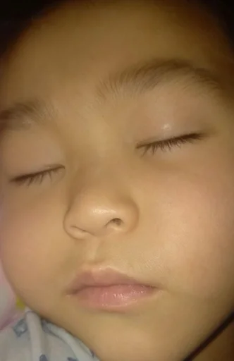 person skin human face