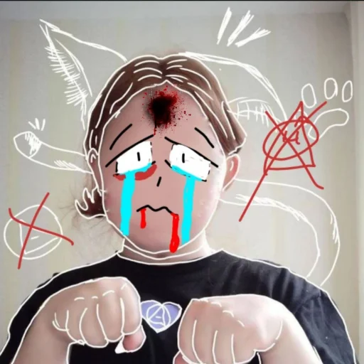 АНТИ КВД И АНТИ ФУРРИ @anti_kvd_kivv - 