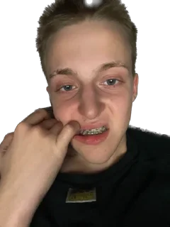 person human face forehead