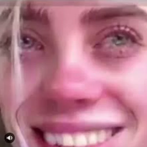 улыбаться зуб губа