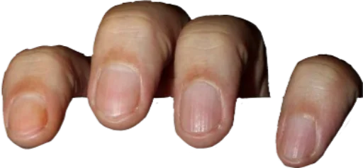 гвоздь палец плоть