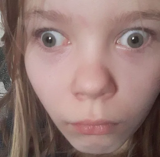 Стикер конченая дурочка :: @fStikBot - 2