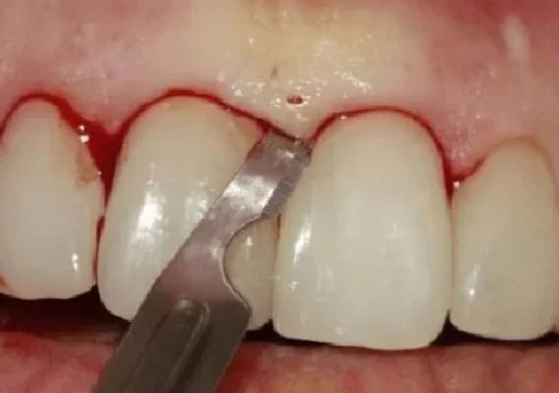 Стикер deathniggerss - 1