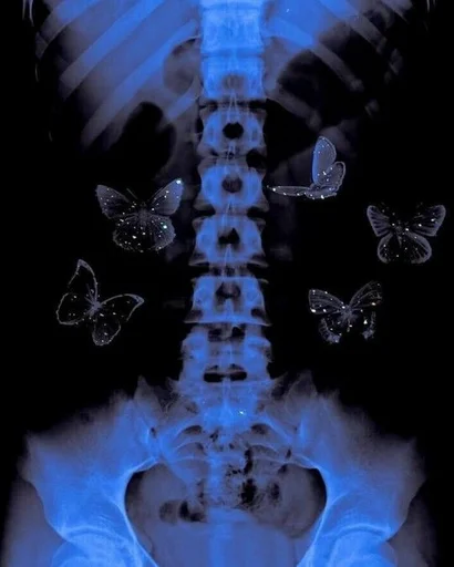 x-ray film art
