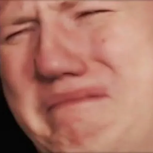 skin person forehead