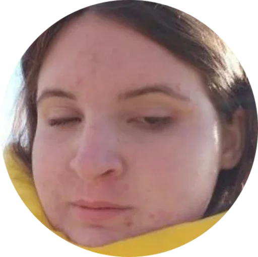 human face closeup forehead