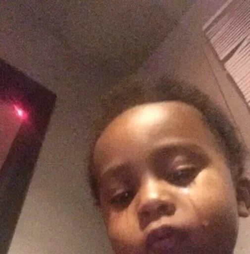 human face selfie forehead