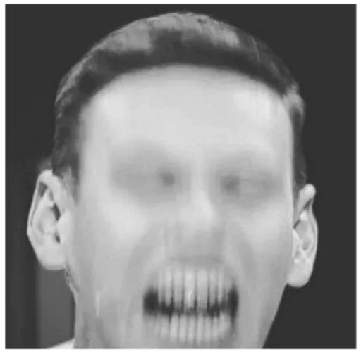 челюсть лоб зуб