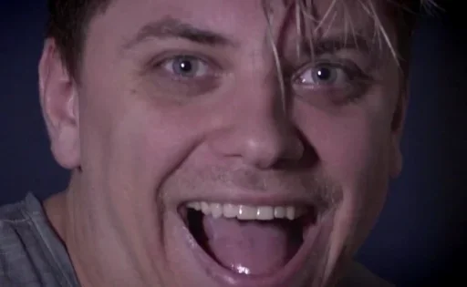 Человек челюсть зуб