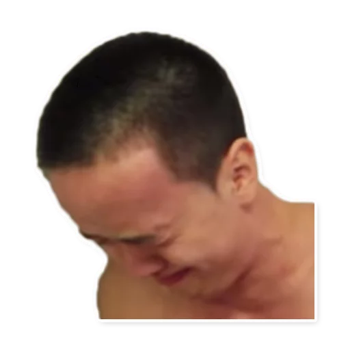 щека кожа шея