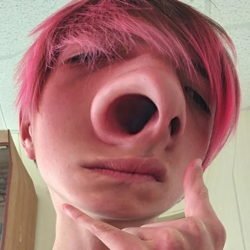 Человек щека губа