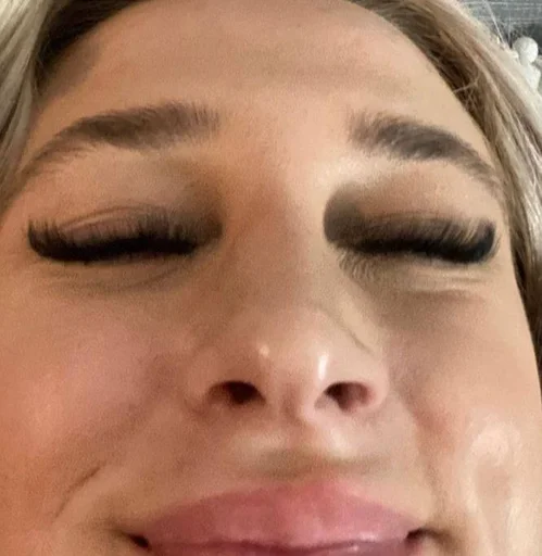 eyelash skin closeup