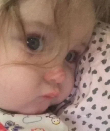 Человек кожа щека