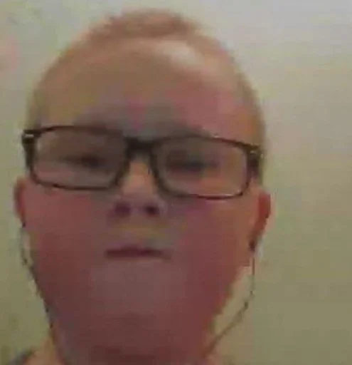 forehead person human face