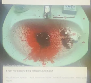 Sticker инсультная грыжа молодого наркозависимого - 4