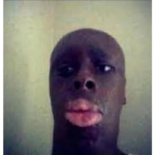 СМС щека челюсть