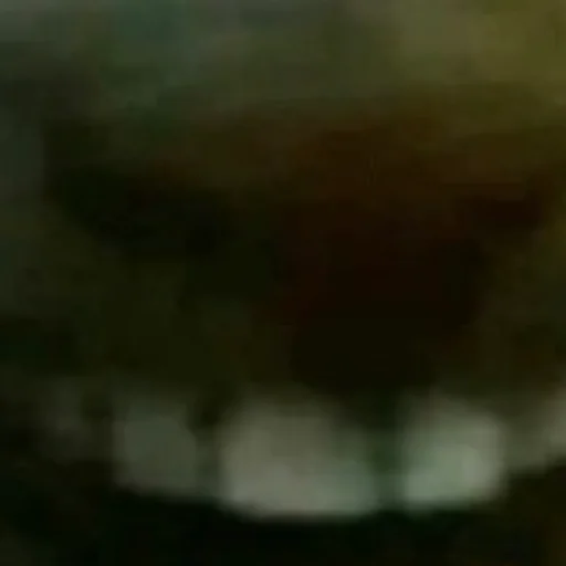 blurry black x-ray film