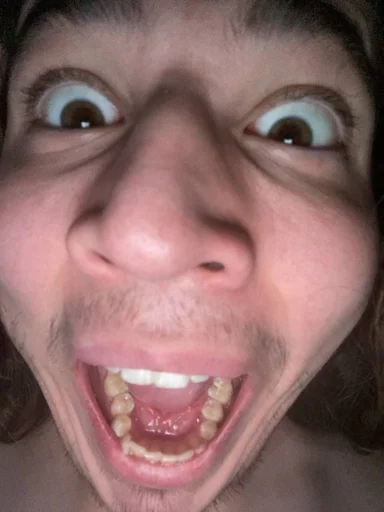 зуб Человек губа