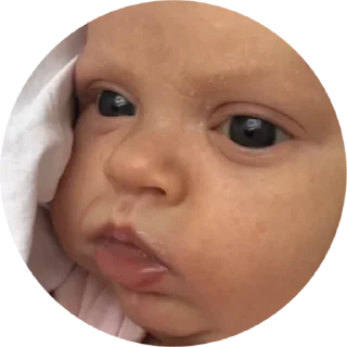 baby cheek skin