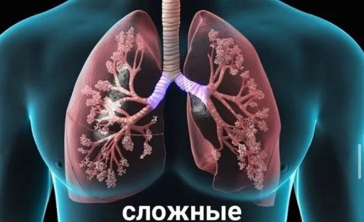 Sticker khen_de_khokh_by_TgEmodziBot - 1