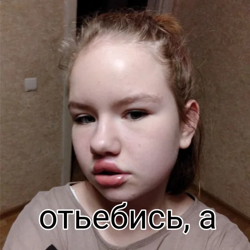 коленочки - 