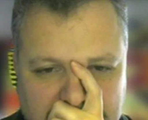 person human face forehead