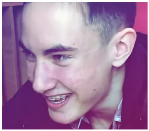 human face person forehead