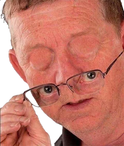 human face person forehead