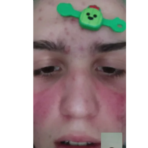 Sticker loxpedalnyi228 - 1