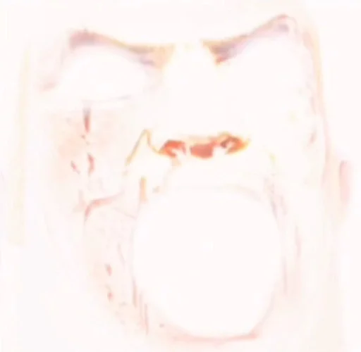 рентгеновская пленка искусство