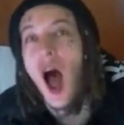 Человек зуб челюсть