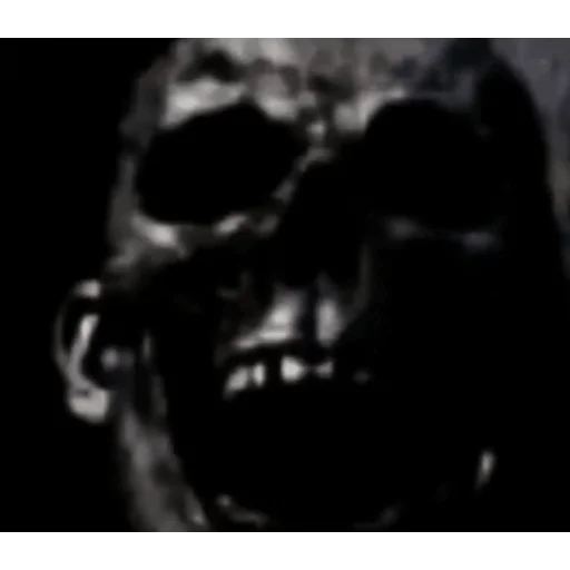 black x-ray film skull