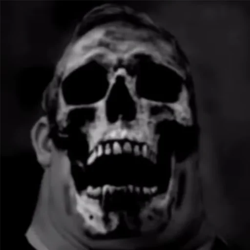 череп кость челюсть