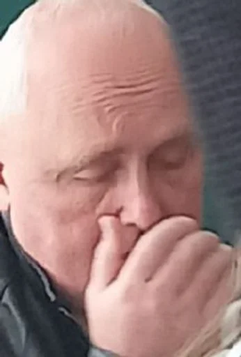 Человек человеческое лицо кожа