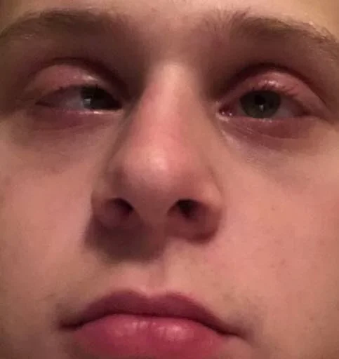 human face skin person