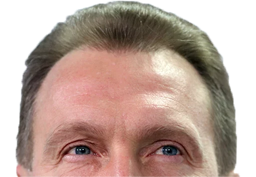 forehead human face eyebrow