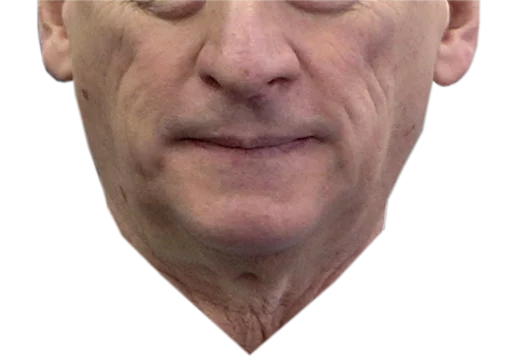 human face forehead cheek