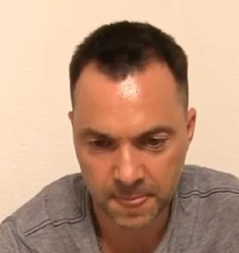 Человек человеческое лицо лоб