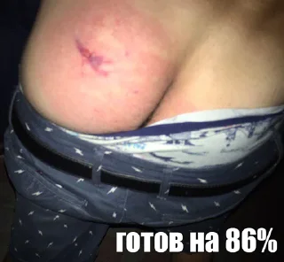 Sticker пукянскфлекс - 7