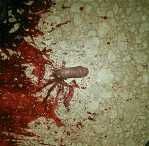 invertebrate animal blood