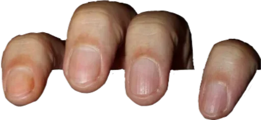 nail finger flesh