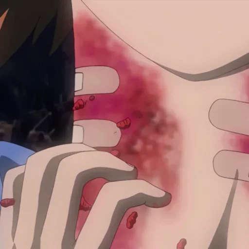 реныч сосочка - 