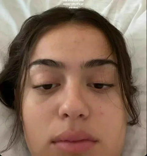 human face skin eyebrow