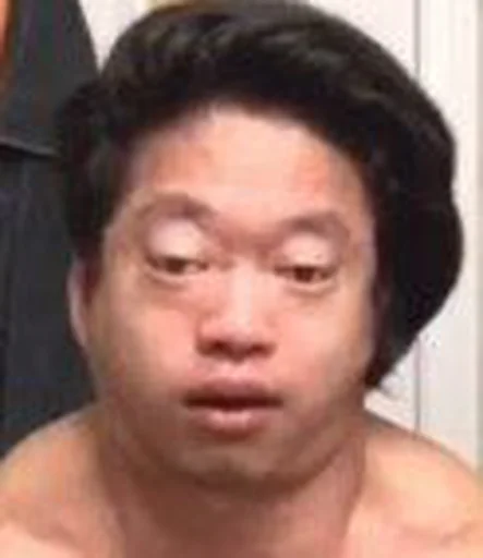 person human face skin