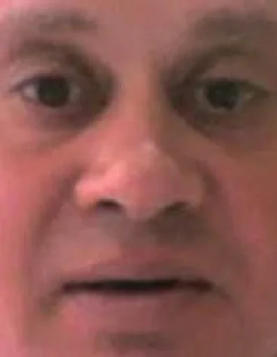 human face forehead skin