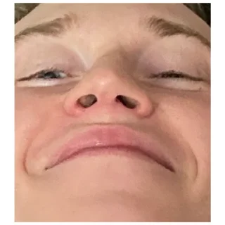 Sticker Нефоры - 2