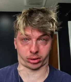 Sticker Миша хуйло здарова - 1