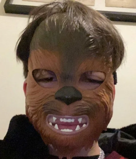 лоб челюсть щека