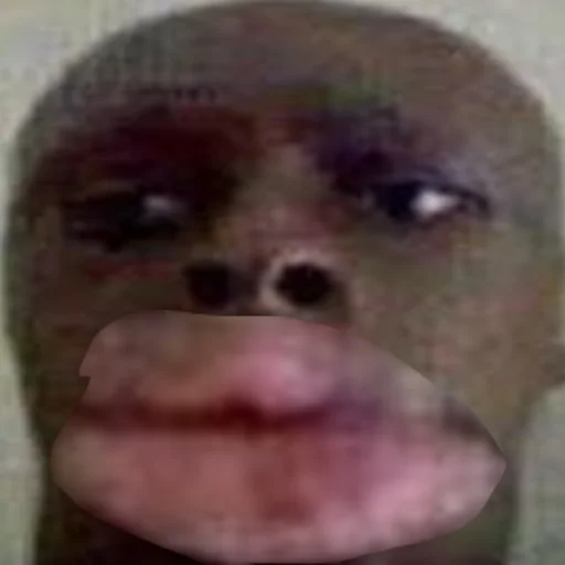 Человек кожа щека