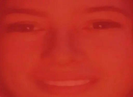 лоб губа щека